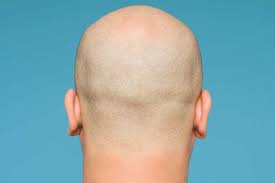 The bald and the beautiful: why do men still fear hair loss ...